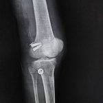 WhatsApp Image 2026-01-16 at 1.40.19 PM