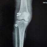 WhatsApp Image 2026-01-16 at 1.40.20 PM (1)